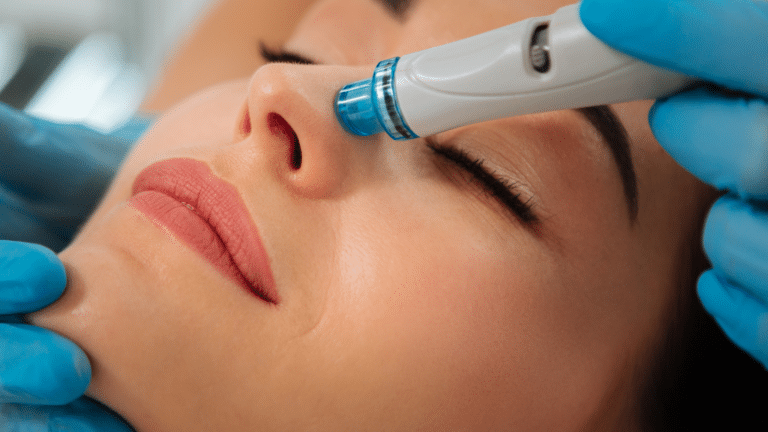 Hydrafacial fréquence
