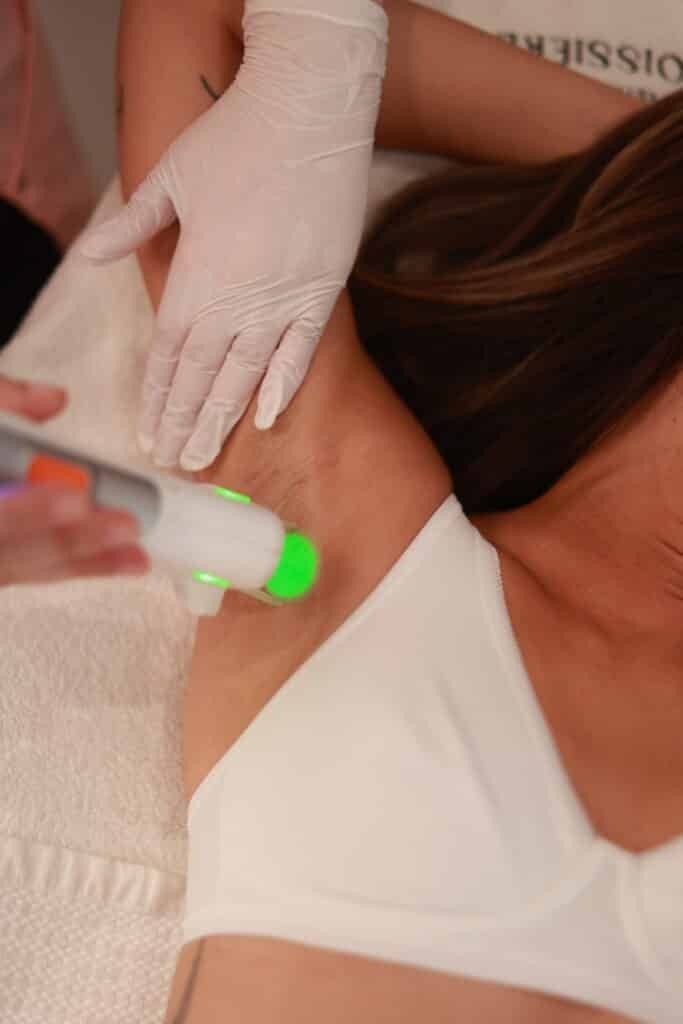 Epilation laser aisselles Paris 16