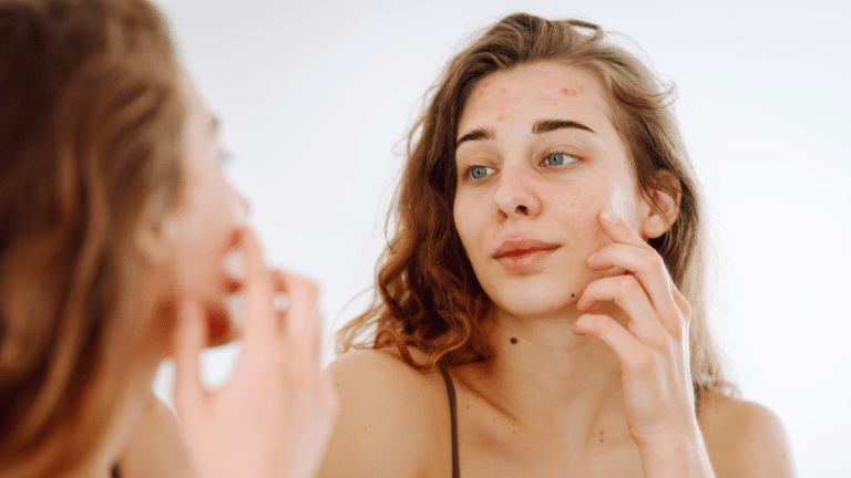 Peau déshydratée Hydrafacial